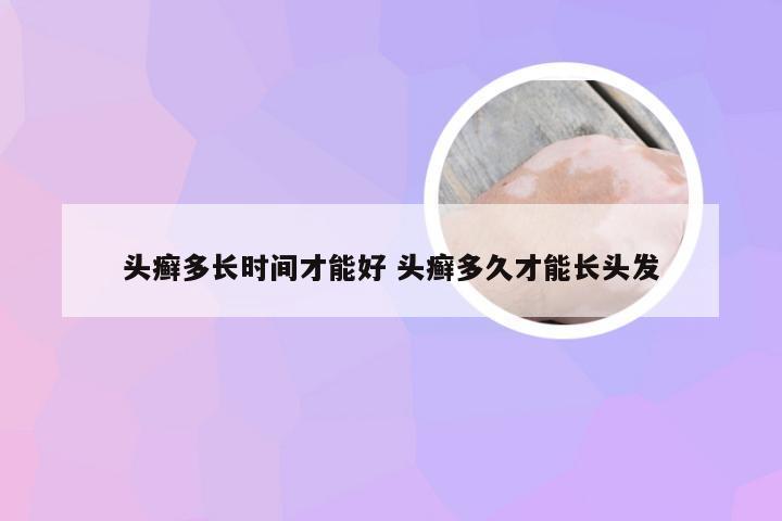 头癣多长时间才能好 头癣多久才能长头发