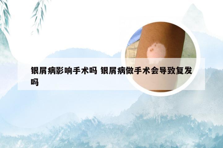 银屑病影响手术吗 银屑病做手术会导致复发吗