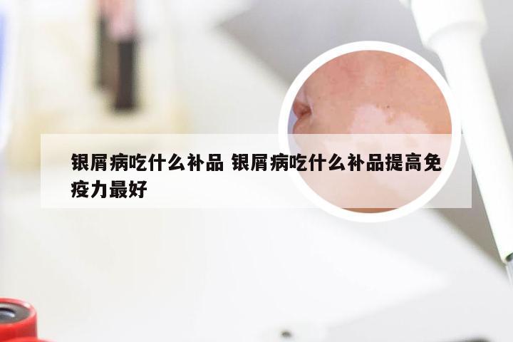 银屑病吃什么补品 银屑病吃什么补品提高免疫力最好