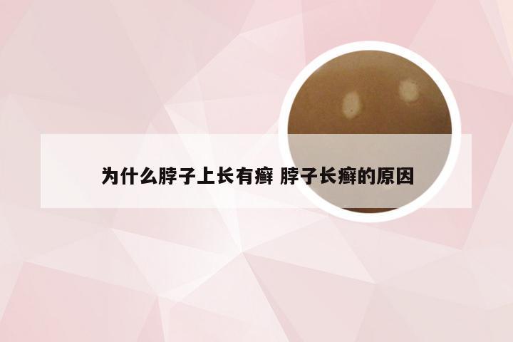 为什么脖子上长有癣 脖子长癣的原因