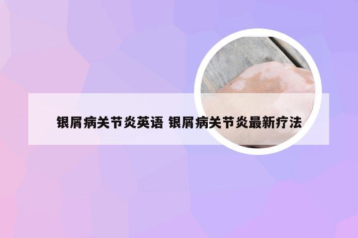 银屑病关节炎英语 银屑病关节炎最新疗法