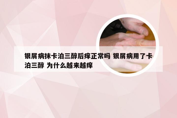 银屑病抹卡泊三醇后痒正常吗 银屑病用了卡泊三醇 为什么越来越痒