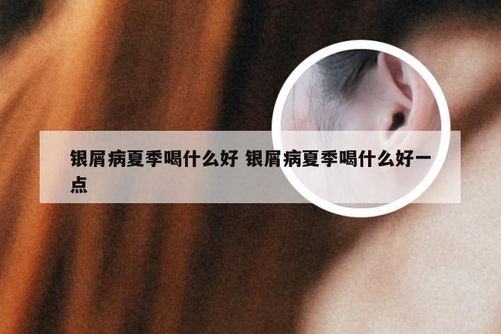 银屑病夏季喝什么好 银屑病夏季喝什么好一点