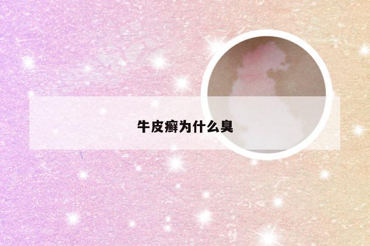 牛皮癣为什么臭