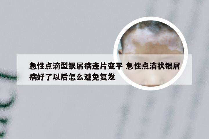 急性点滴型银屑病连片变平 急性点滴状银屑病好了以后怎么避免复发