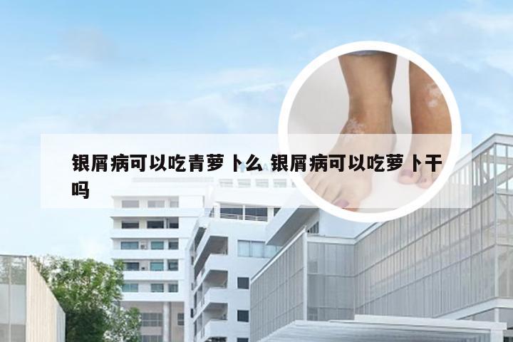 银屑病可以吃青萝卜么 银屑病可以吃萝卜干吗