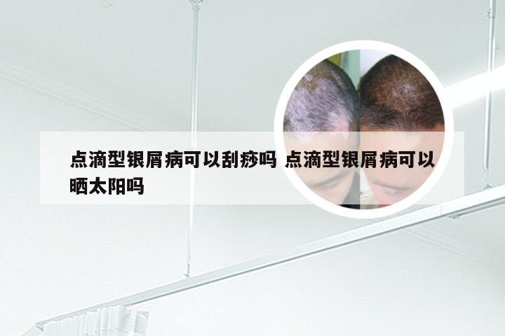 点滴型银屑病可以刮痧吗 点滴型银屑病可以晒太阳吗