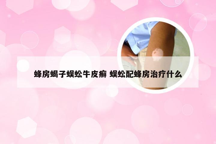 蜂房蝎子蜈蚣牛皮癣 蜈蚣配蜂房治疗什么