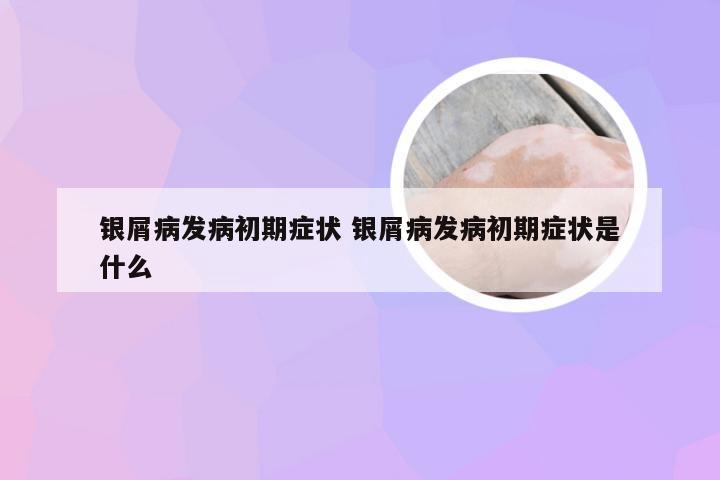 银屑病发病初期症状 银屑病发病初期症状是什么