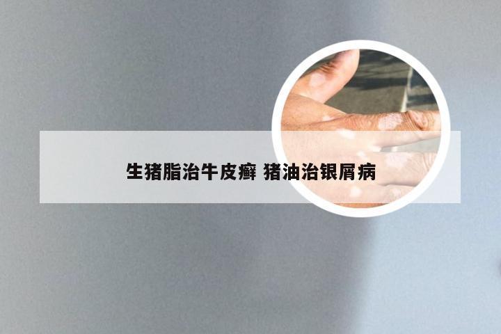 生猪脂治牛皮癣 猪油治银屑病