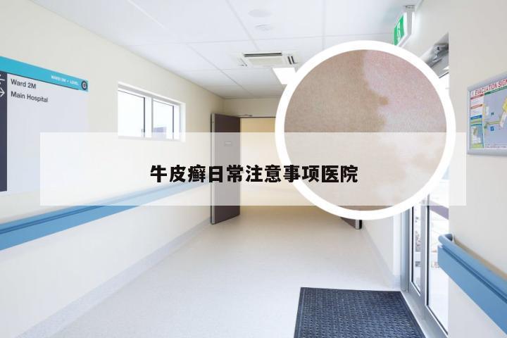牛皮癣日常注意事项医院