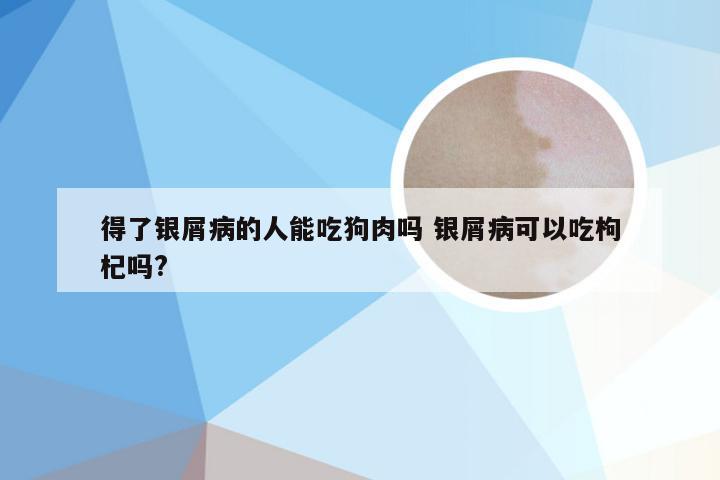 得了银屑病的人能吃狗肉吗 银屑病可以吃枸杞吗?