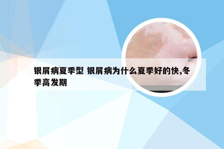 银屑病夏季型 银屑病为什么夏季好的快,冬季高发期