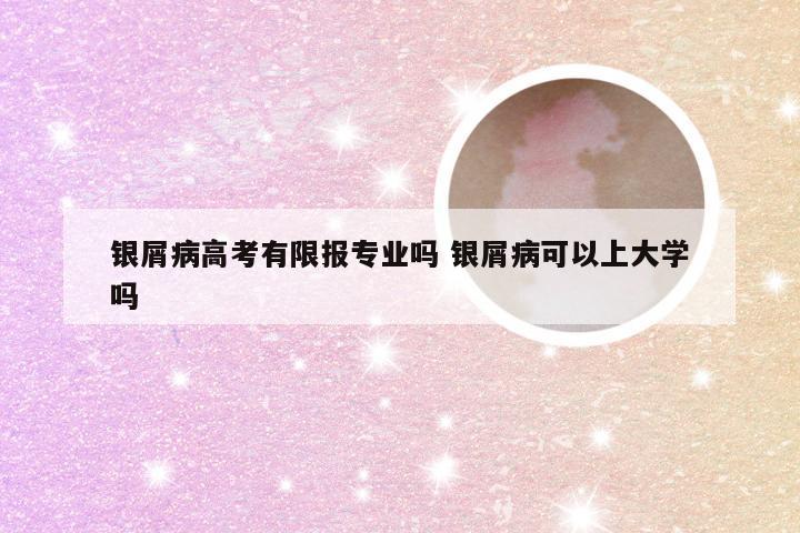 银屑病高考有限报专业吗 银屑病可以上大学吗