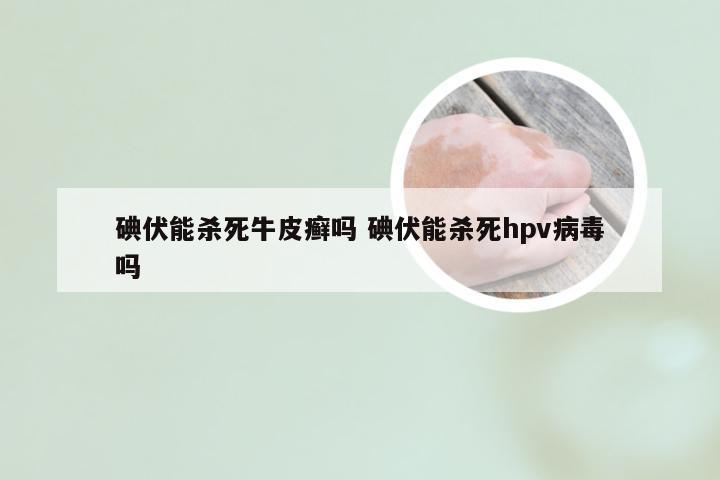 碘伏能杀死牛皮癣吗 碘伏能杀死hpv病毒吗