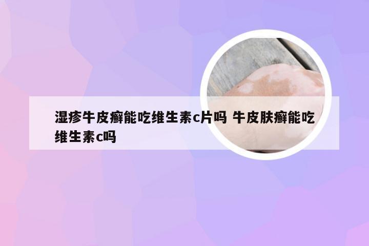 湿疹牛皮癣能吃维生素c片吗 牛皮肤癣能吃维生素c吗