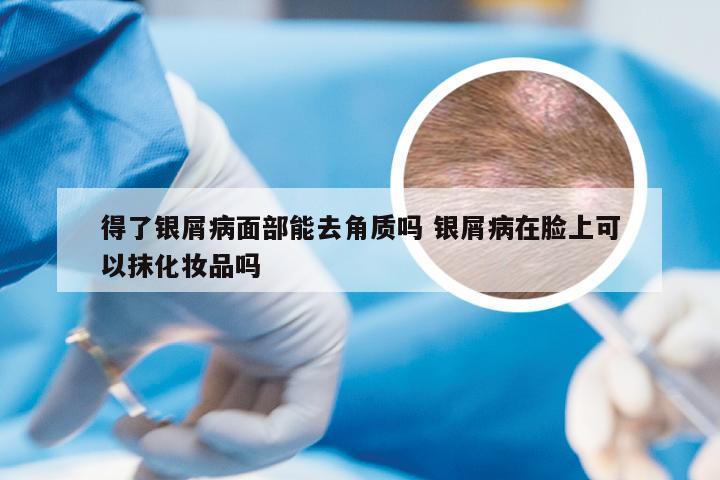 得了银屑病面部能去角质吗 银屑病在脸上可以抹化妆品吗