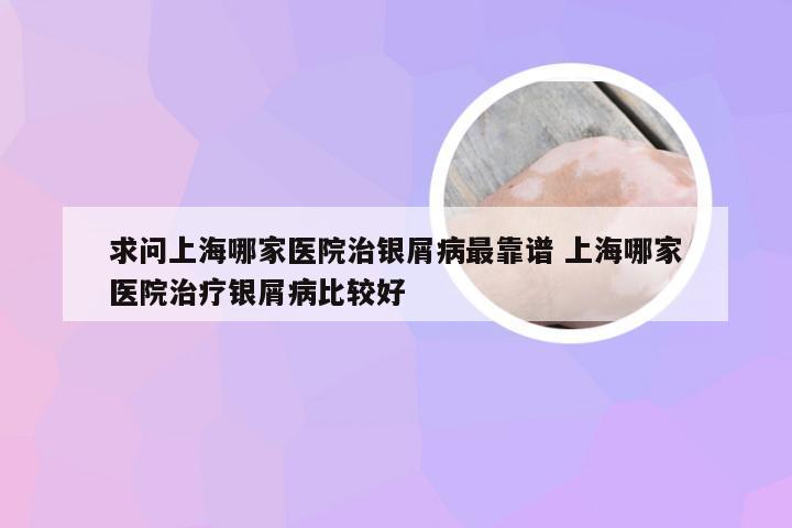 求问上海哪家医院治银屑病最靠谱 上海哪家医院治疗银屑病比较好