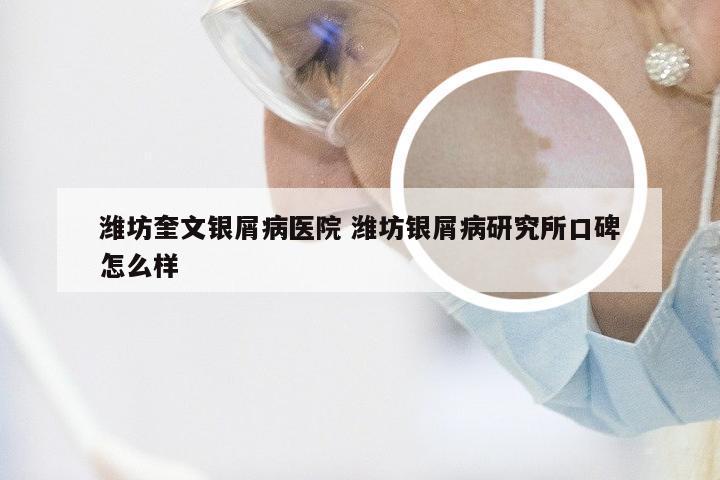 潍坊奎文银屑病医院 潍坊银屑病研究所口碑怎么样