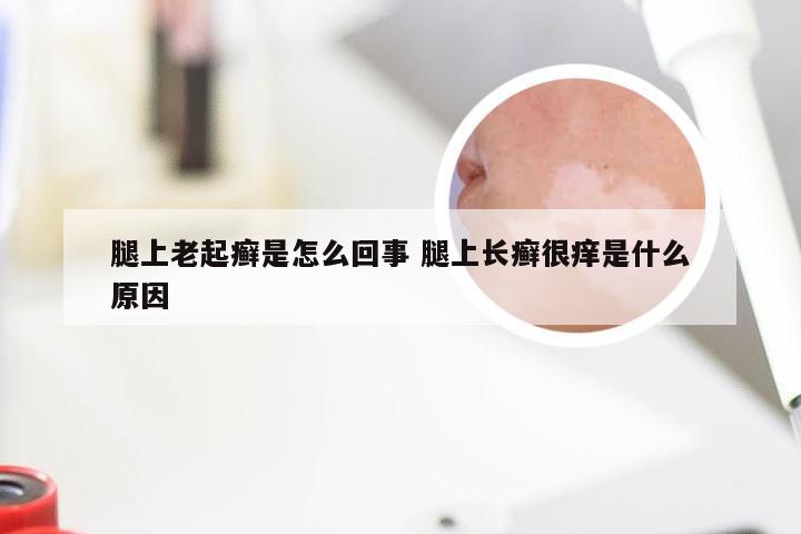 腿上老起癣是怎么回事 腿上长癣很痒是什么原因