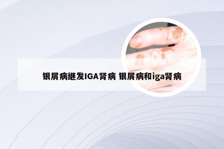 银屑病继发IGA肾病 银屑病和iga肾病