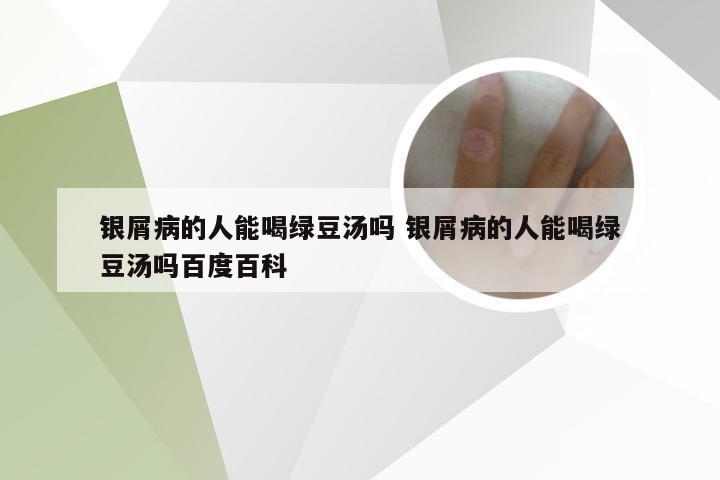 银屑病的人能喝绿豆汤吗 银屑病的人能喝绿豆汤吗百度百科