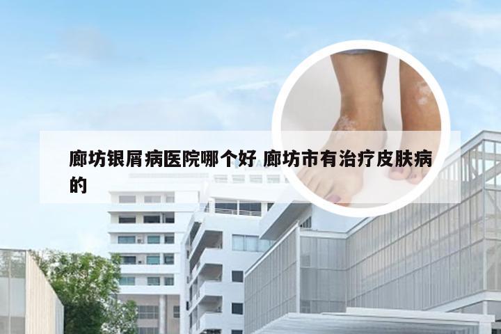 廊坊银屑病医院哪个好 廊坊市有治疗皮肤病的