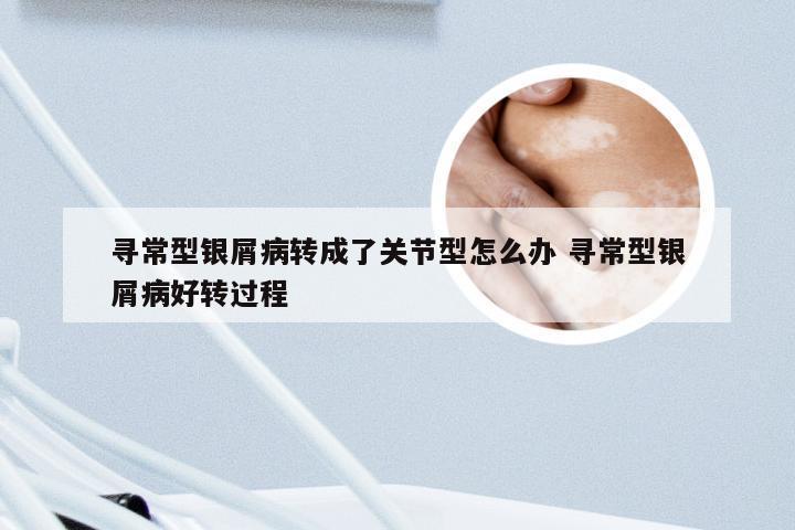 寻常型银屑病转成了关节型怎么办 寻常型银屑病好转过程