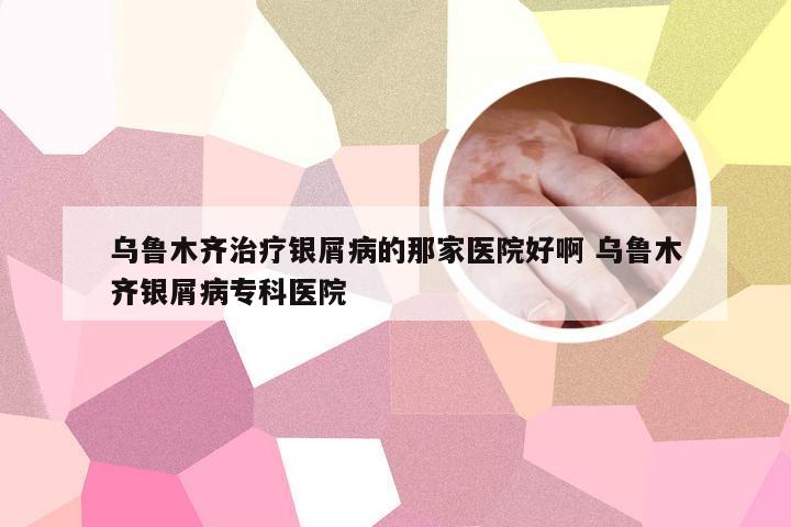 乌鲁木齐治疗银屑病的那家医院好啊 乌鲁木齐银屑病专科医院