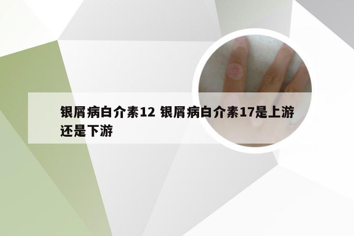 银屑病白介素12 银屑病白介素17是上游还是下游