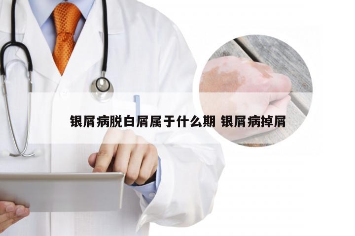 银屑病脱白屑属于什么期 银屑病掉屑