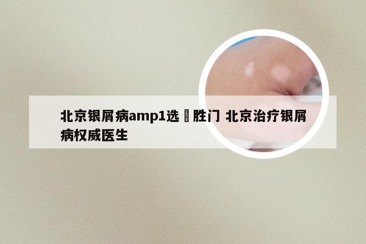 北京银屑病amp1选徳胜门 北京治疗银屑病权威医生