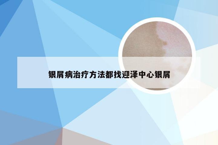 银屑病治疗方法都找迎泽中心银屑