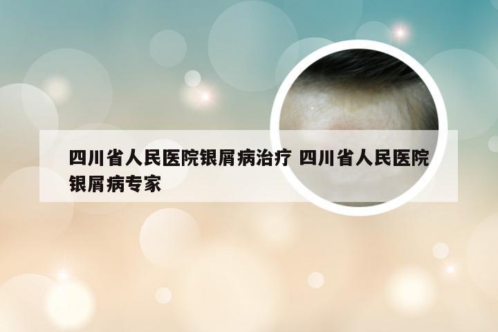 四川省人民医院银屑病治疗 四川省人民医院银屑病专家