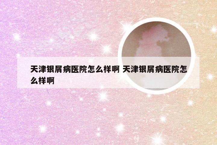 天津银屑病医院怎么样啊 天津银屑病医院怎么样啊