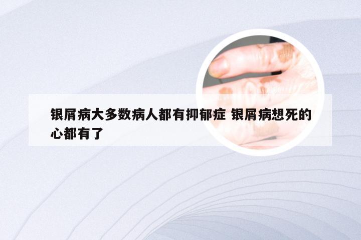 银屑病大多数病人都有抑郁症 银屑病想死的心都有了