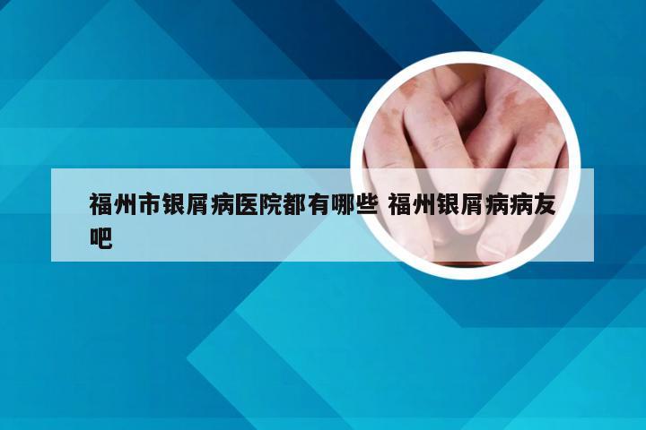 福州市银屑病医院都有哪些 福州银屑病病友吧