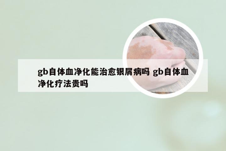 gb自体血净化能治愈银屑病吗 gb自体血净化疗法贵吗