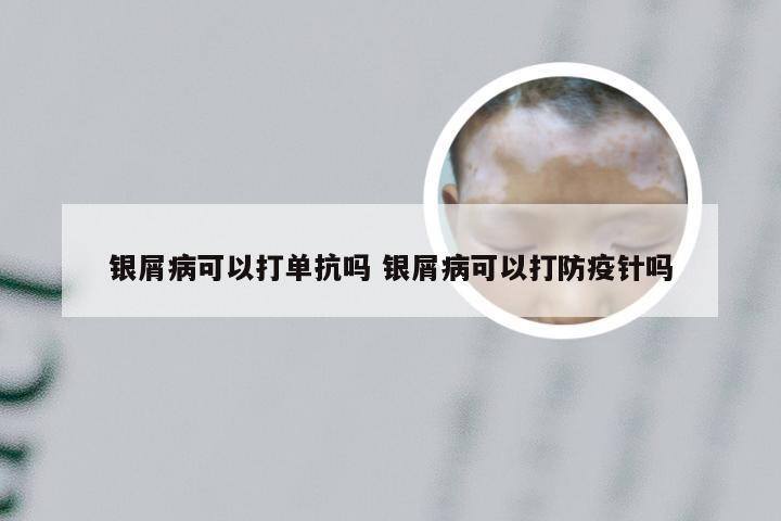 银屑病可以打单抗吗 银屑病可以打防疫针吗