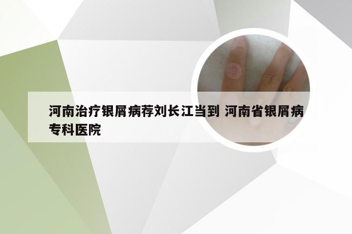 河南治疗银屑病荐刘长江当到 河南省银屑病专科医院