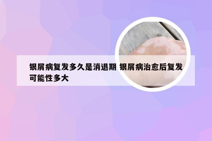 银屑病复发多久是消退期 银屑病治愈后复发可能性多大