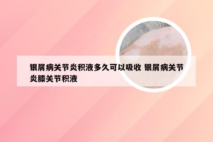 银屑病关节炎积液多久可以吸收 银屑病关节炎膝关节积液