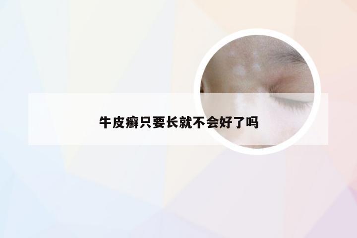 牛皮癣只要长就不会好了吗