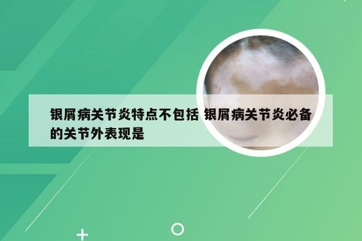 银屑病关节炎特点不包括 银屑病关节炎必备的关节外表现是