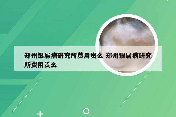 郑州银屑病研究所费用贵么 郑州银屑病研究所费用贵么