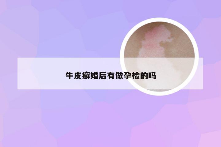 牛皮癣婚后有做孕检的吗