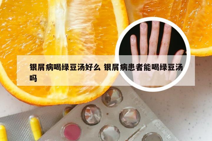 银屑病喝绿豆汤好么 银屑病患者能喝绿豆汤吗