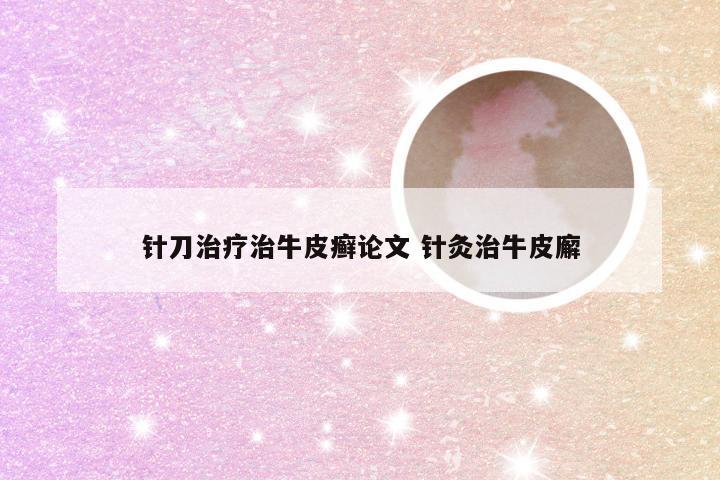 针刀治疗治牛皮癣论文 针灸治牛皮廨