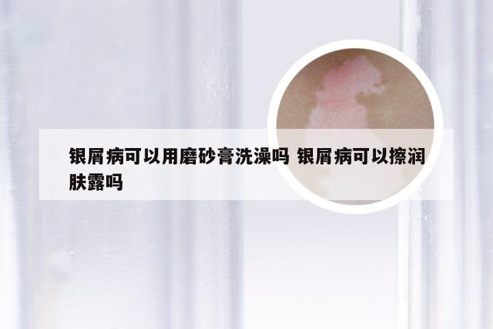 银屑病可以用磨砂膏洗澡吗 银屑病可以擦润肤露吗