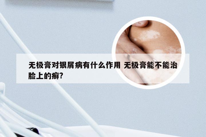 无极膏对银屑病有什么作用 无极膏能不能治脸上的癣?